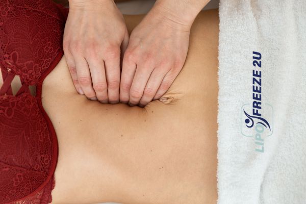 diastasis recti treatment West Sussex