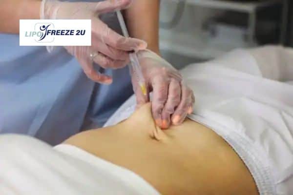 Fat Dissolving Injections West Sussex & Weight loss medication