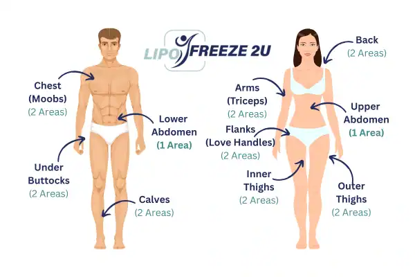 Areas you can have fat freezing treatment West Sussex