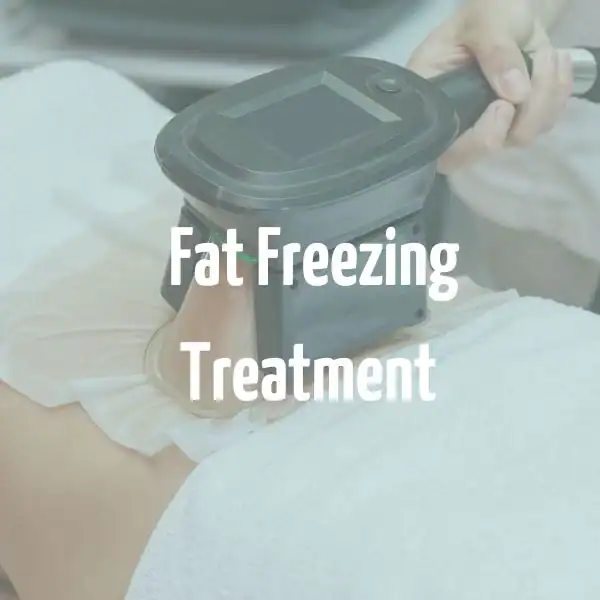 fat freezing treatment West Sussex