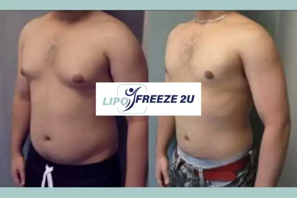 How Long Does It Take to See Results West Sussex?
