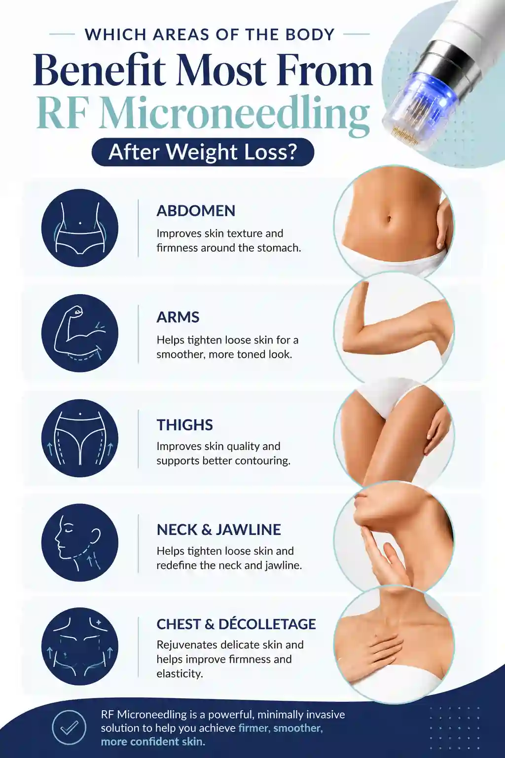 Which Areas of the Body Benefit Most From RF Microneedling After Weight Loss West Sussex